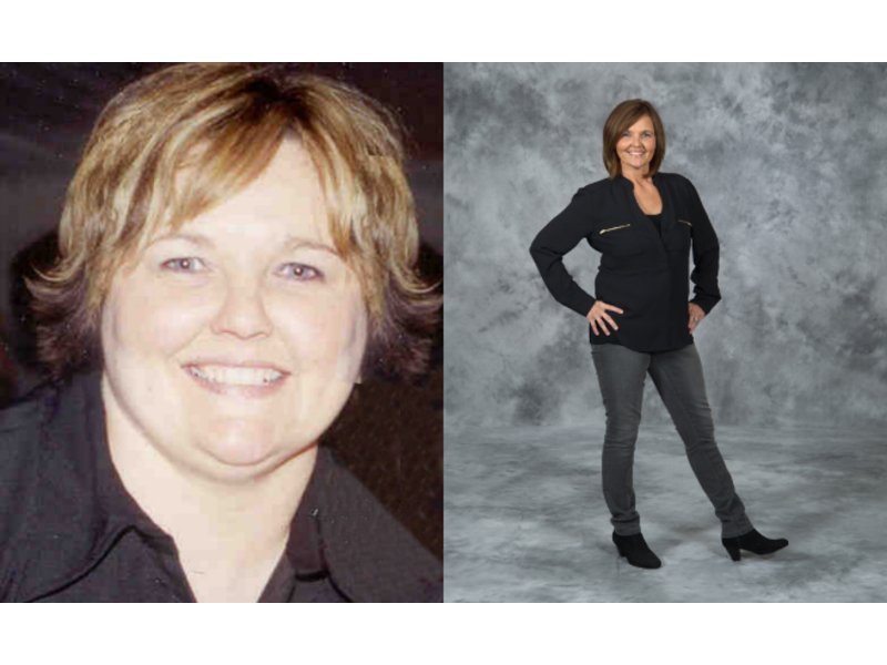 Still Slim and Healthy 10 Years After Weight-Loss Surgery | Lemont ...