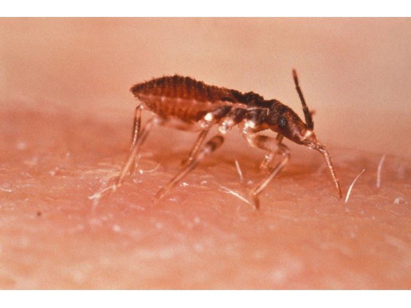6 Facts About 'Deadly Kissing Bugs' Found in Illinois Patch