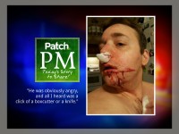 Irate Motorist Cuts and Runs in Slash Attack: Patch PM