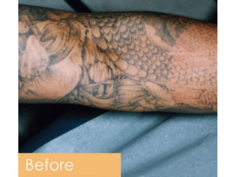Carmen Vanderheiden started out with laser hair removal business, and ...