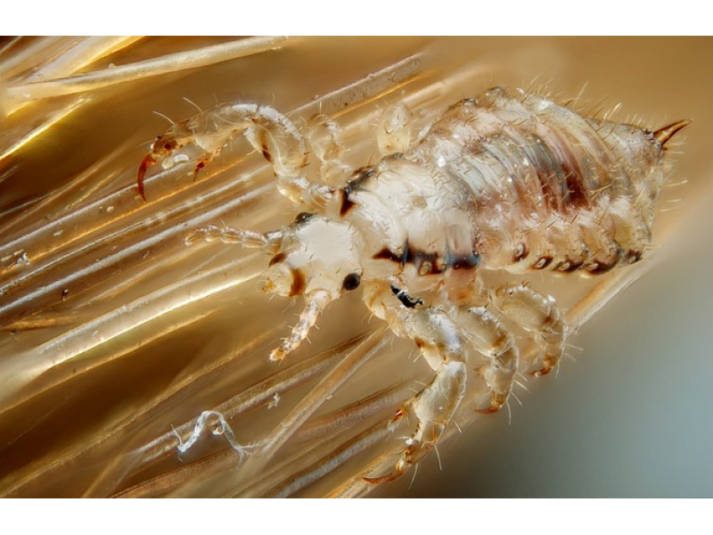 Mutated 'Super Lice' Strike in New Jersey, 28 Other States